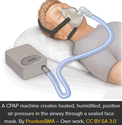  CPAP machine creates heated, humidified, positive air pressure in the airway through a sealed face mask. By PruebasBMA